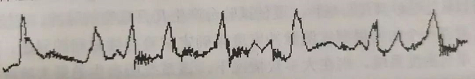 電子產(chǎn)品抗震緩沖性能檢測方法與技術簡介